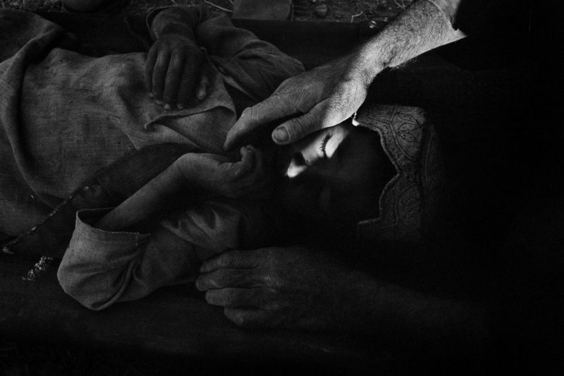 Stephen Dupont - A wounded Afghan boy who had been shot in crossfire during a battle between US soldiers and Taliban in Gonbaz village, Kandahar Province, Afghanistan, 2005