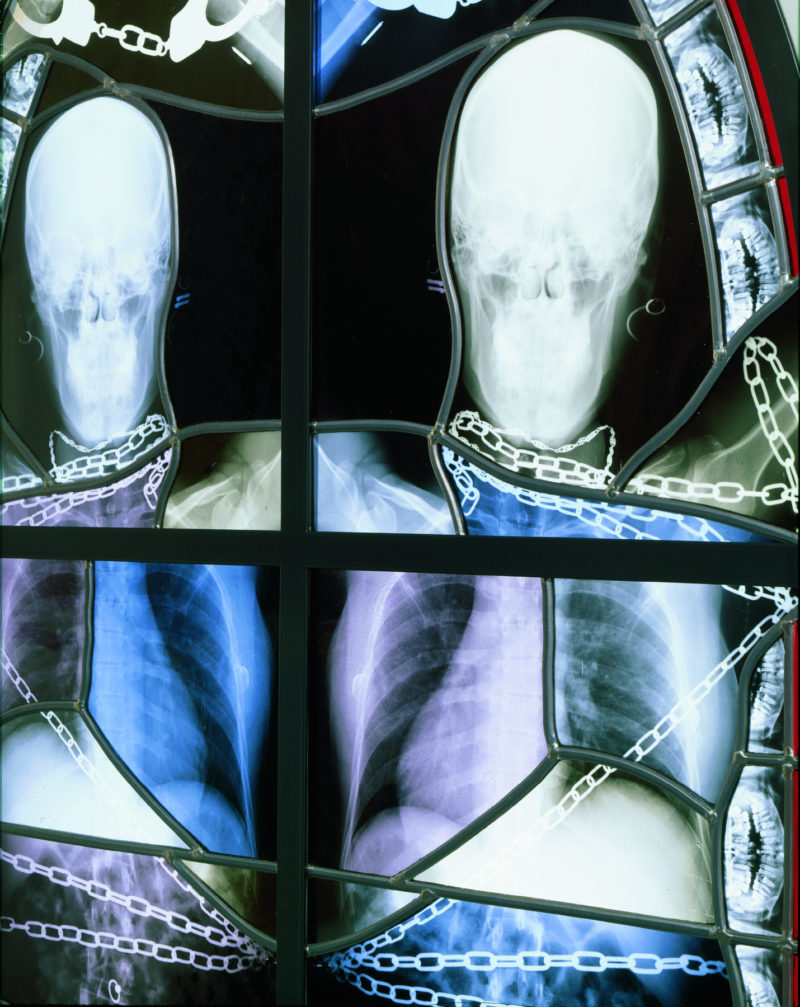 Wim Delvoye - Caliope (detail), 2001-2002, steel, x-ray photographs, lead, glass, 200 x 80 cm