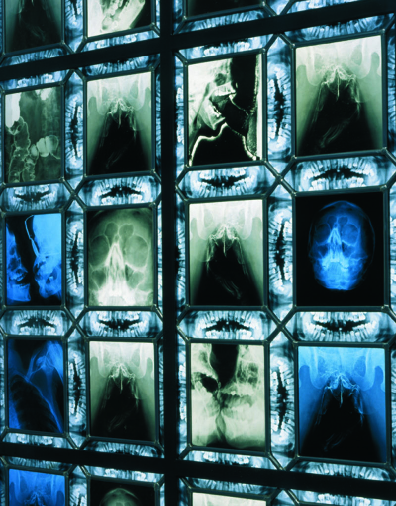 Wim Delvoye - Euterpe (detail), 2001-2002, steel, x-ray photographs, lead, glass, 200 x 80 cm